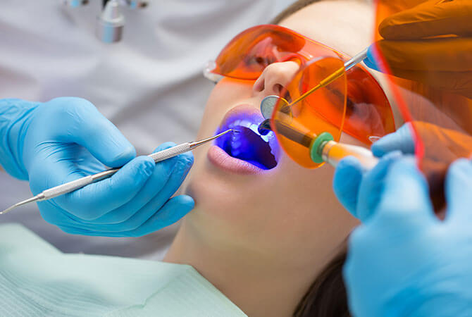 family dentistry dental sealants in lincoln illinois