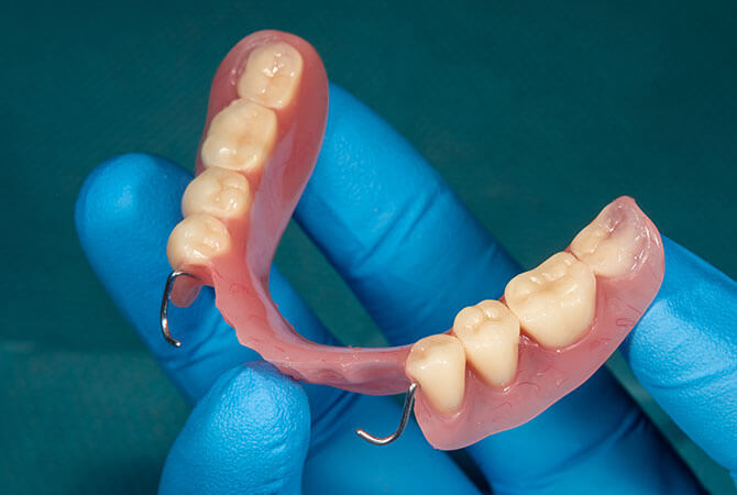 dental partials near central illinois